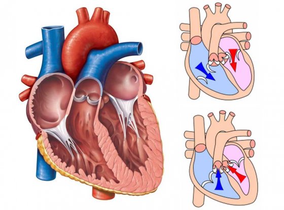 Ürəyin qapaq xəstəliklərində müdaxilələr
